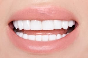 up close photo of woman with beautiful porcelain veneers