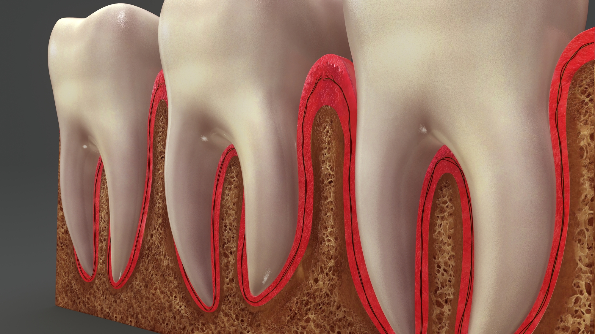 Am I at risk for gum disease? 
