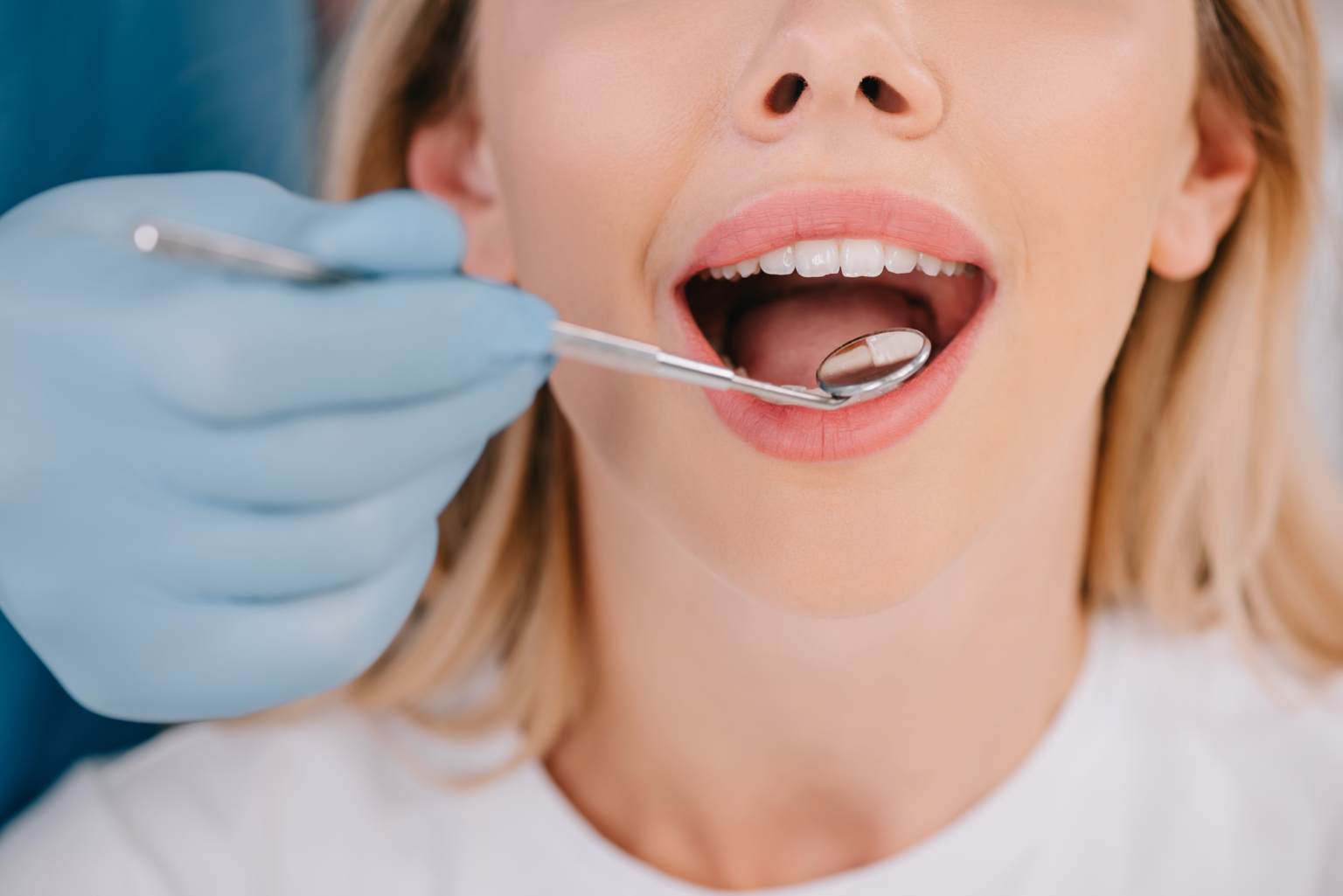 Tooth Extraction vs. Tooth Restoration Which is right for me? Metro