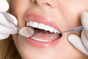 close up of woman's perfect teeth after cosmetic dentistry with a dental mirror and dental pick in her mouth