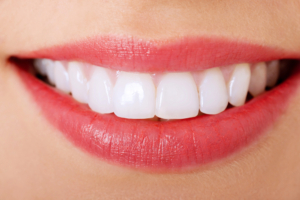 close up of woman's smile after cosmetic dentistry