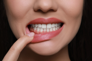 close up of woman showing her bottom gums