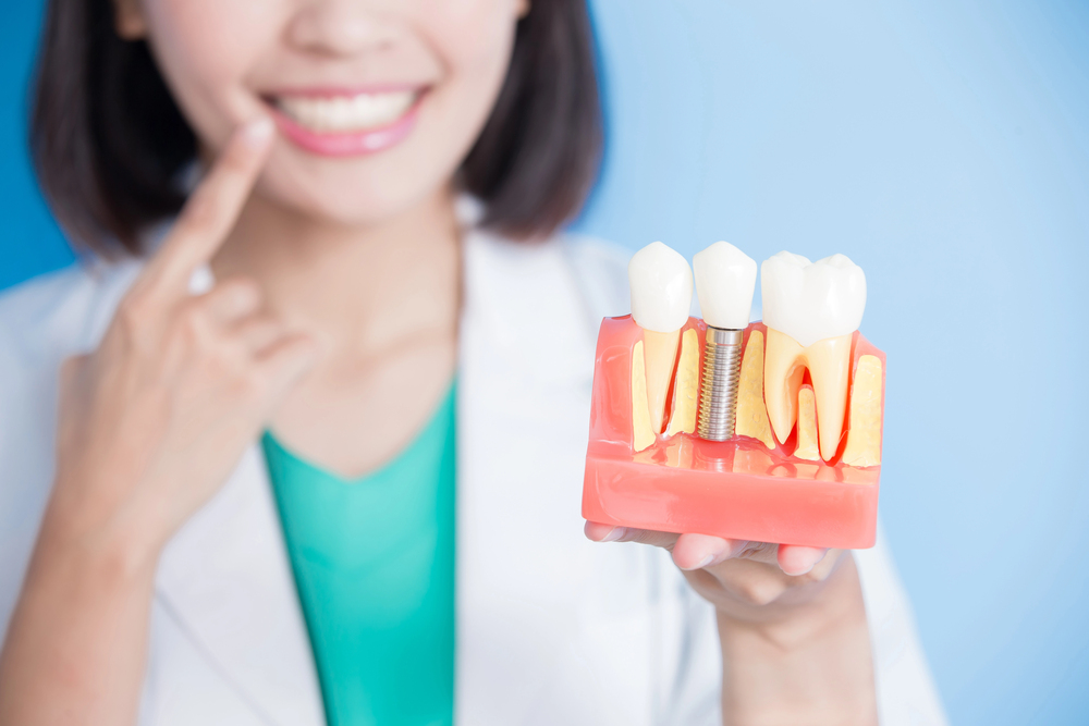 dentist with dental implant tooth model